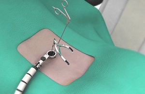 Minimally Invasive Surgery